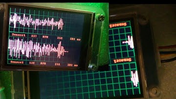 Detox4health first Prototype
