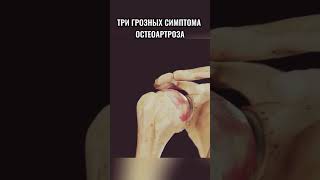 Боль при движении? Утренняя скованность?Ограничение подвижности? Пиши СУСТАВ, проконсультирую.