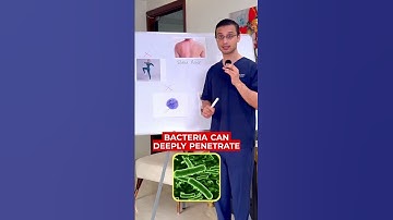 Good Bye To Back Acne. || Dr.Sarin ||