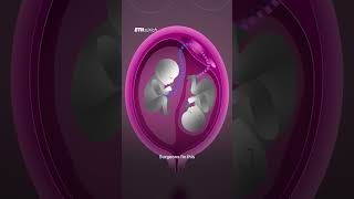 Robotic Fetal Surgery Platform