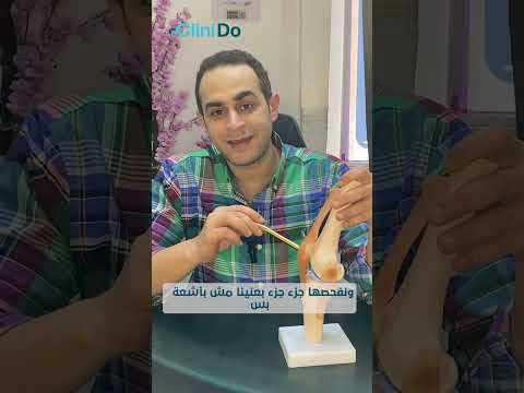 إيه هو الم نظار الجراحي وإيه دوره في جراحة العظام