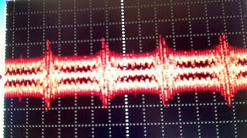Eye Diagram for Multi-Level PAM-3 Signaling