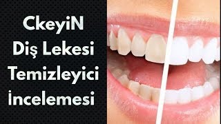 CkeyiN Diş Lekesi Temizleyici İncelemesi GearBest Alışverişim #19