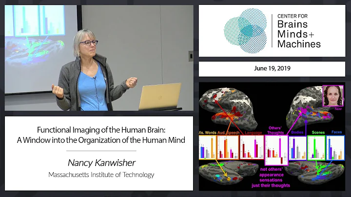 Functional Imaging of the Human Brain: A Window in...