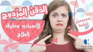 الذقن المزدوج - اسبابه وطرق علاجه الغير جراحية في بغداد