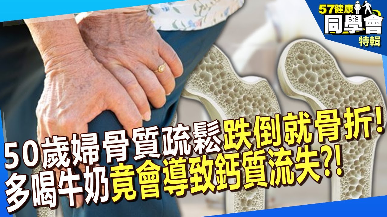 【精選】50歲婦骨質疏鬆「跌倒就骨折」！多喝牛奶竟會導致鈣質流失？8點建議讓你「膝蓋骨勇健」【57健康同學會】