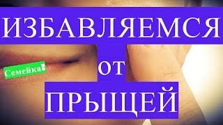 Как избавится ОТ ПРЫЩЕЙ в домашних условиях на лице подростку. Акне. Угри. Лечение. На лбу(Расскажу, как избавиться от прыщей подростку девушке или парню. Избавляемся от прыщей в домашних условиях..., 2015-11-01T17:08:13.000Z)