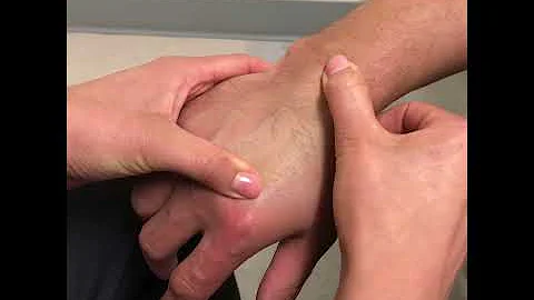 How To Find And Avoid Valves During IV Insertion