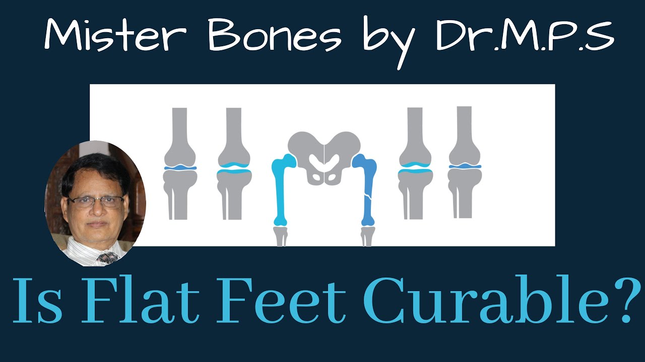 Is Flat feet curable? YouTube
