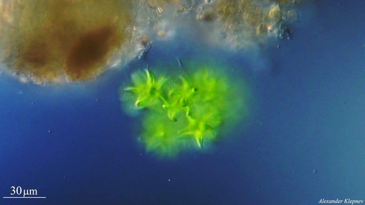 Колониальными водорослями являются. Колониальные водоросли. Нитчатые водоросли под микроскопом. Колониальные водоросли 12 букв.