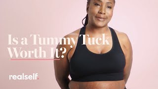 Is A Tummy Tuck Worth It? Everything You Need To Know About This Body-Contouring Surgery