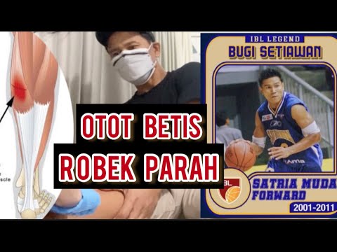 Video: Cara Mengobati Otot Betis yang Robek: 14 Langkah (dengan Gambar)