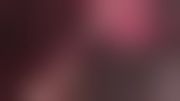 En bloc Right Tri-segmentectomy. Bismuth-Corlette Type 3A perihilar cholangiocarcinoma, Part 2