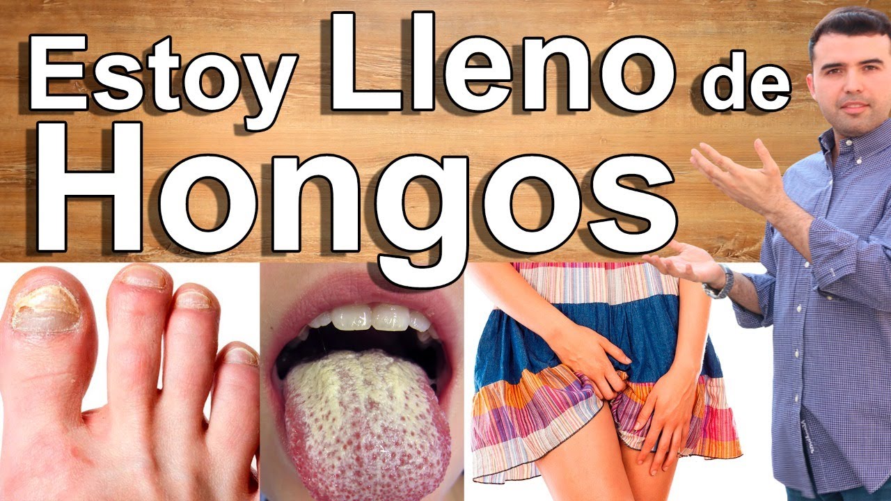 Estoy Lleno De Hongos - EN VIVO - Porque Estoy Lleno De Hongos Y Como Eliminarlos