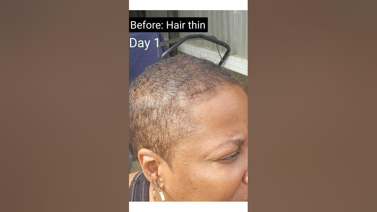 RGS Hair Serum Testimonial Recovers damaged scalp and hair shafts