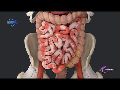 【System anatomy】: Large intestine, cecum and vermiform appendix|【系统解剖】：大肠、盲肠和阑尾