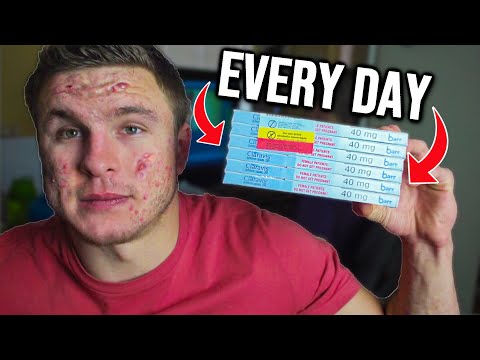 I Took The World's Highest Dose of Accutane & What Happened...