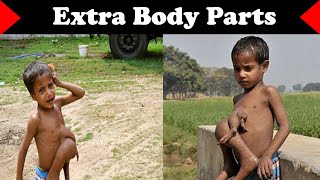 Deepak Paswan With Extra Body Parts Sub Such Hai