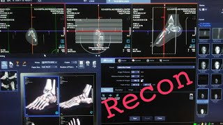 Recon, How to CT Recon,Siemens healthineers SOMATOM. go CT Scan. Recon, How to CT Recon,Siemens healthineers SOMATOM. go CT Scan.
