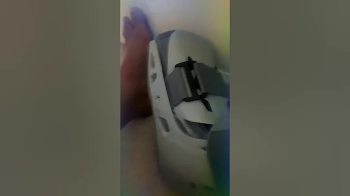 Hurt leg