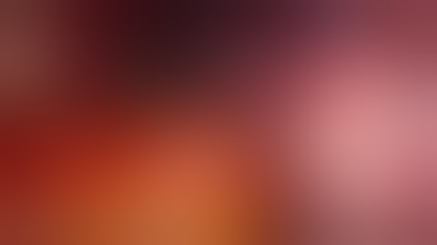 TEP Lap Inguinal Hernia Repair - Dissection of Bilateral Hernia Using Lap Progrip Mesh