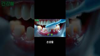 바나나 껍질로 치아 미백 전문가의 견해#바나나#보톡스