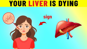 10 Early Warning Signs of Fatty Liver Disease!