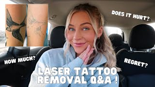 LASER TATTOO REMOVAL Q&A | PAIN? REGRET? ANSWERING MY MOST FAQ'S 😬😱