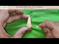 02 Buccal aspect of Maxillary First Premolar