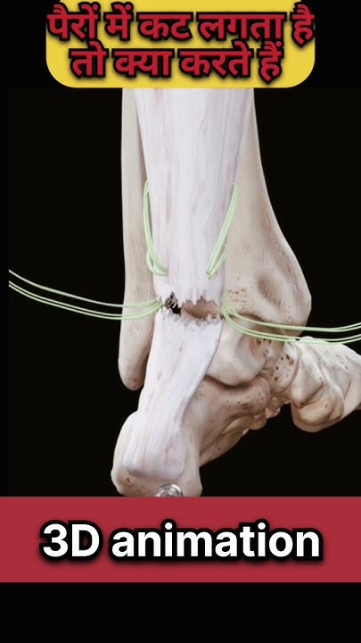 what-does-doctor-do-if-there-is-a-cut-in-the-feet-3d-animation-shorts