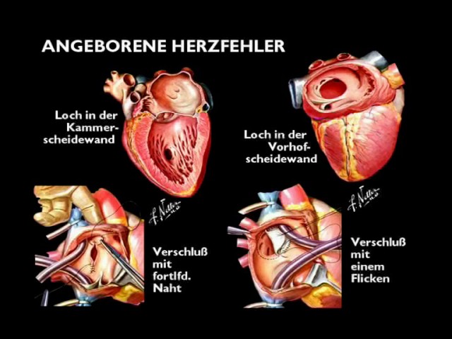 Virtuelle Reise durch das Herz