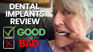 10 Problems With My Dental Implants  3 Years Later