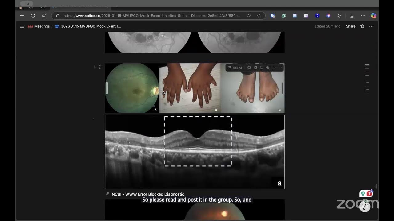 [MVUPGO] FRCS Mock Exam on Inherited Retinal Diseases: Dr Koushik Tripathy, India