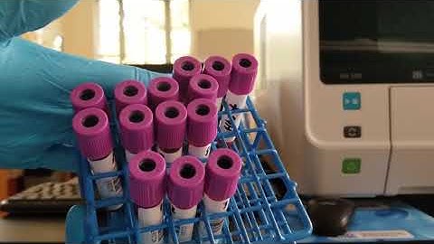 Hematology: Performing Sample Drawer & Manual "STAT" Analysis on Sysmex XN 550