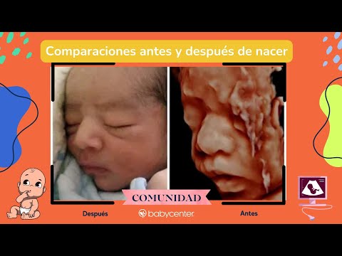 Comparaciones antes y después de nacer