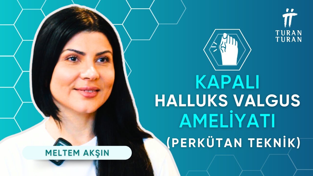 Kapalı Hallux Valgus Ameliyatı Olanların Yorumları: Perkütan Yöntemle Hızlı İyileşme