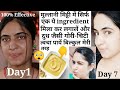               skin whitening treatment