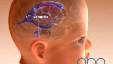 Brain Ventricle of a Baby