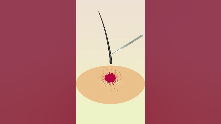 Tweezing hair removal looks more like destroying hair than pulling it out #skincare #satisfying