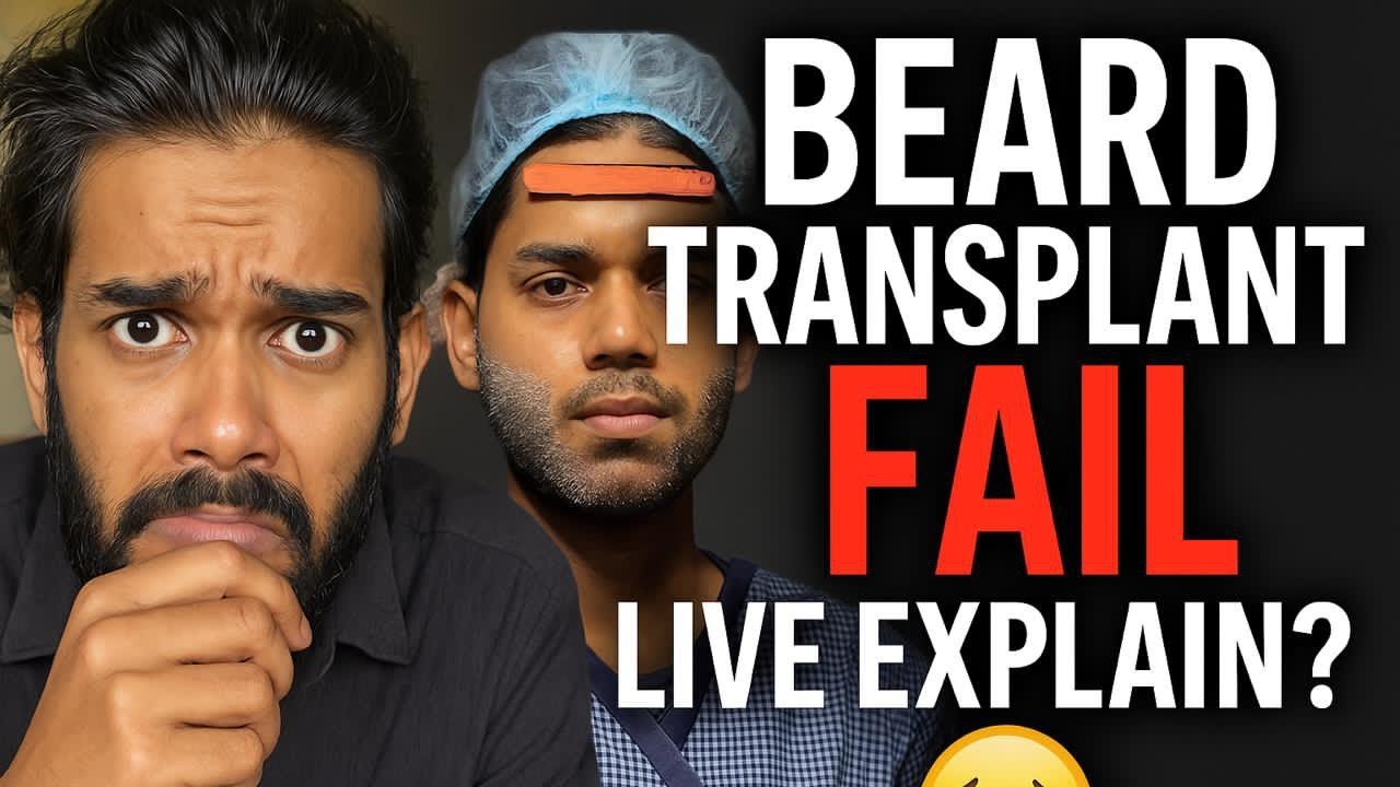 Beard transplant fail in live, explaination 😔 - YouTube