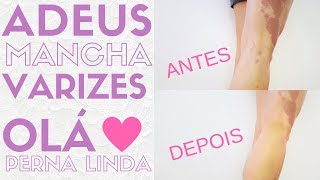 Varizes calças cobrir justas para