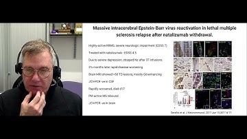 The Future of Multiple Sclerosis Therapy