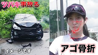 【不運】乗ってたタクシーが正面衝突...ツバキがアゴ骨折。