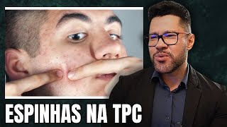 Download Lagu Pimples during PCT? Find out what might be happening to your hormones - #DRJORGERESPONDE Download Lagu Pimples during PCT? Find out what might be happening to your hormones - #DRJORGERESPONDE