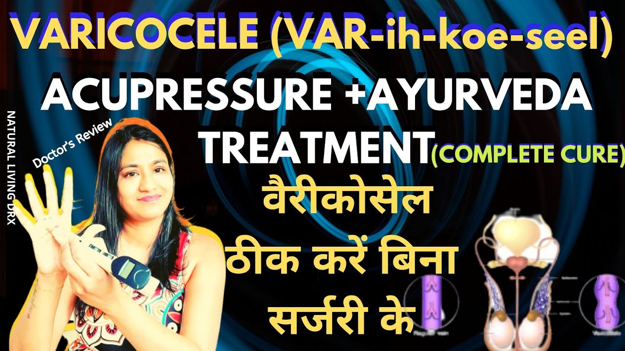Acupressure points for Varicocele varicocele Acupressure , Ayurveda