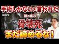 【手術しかない？】膝骨壊死の痛みが改善する治療法【名医が教えます】