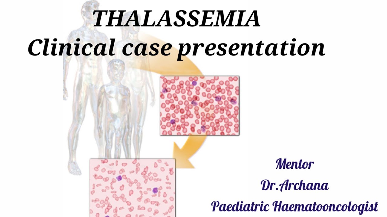 case study for thalassemia