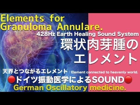 🔴Granuloma Annulare by German Oscillatory Medicine.｜428Hz. Element connected to heavenly world.