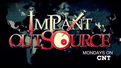 GTA V - Implant Outsource