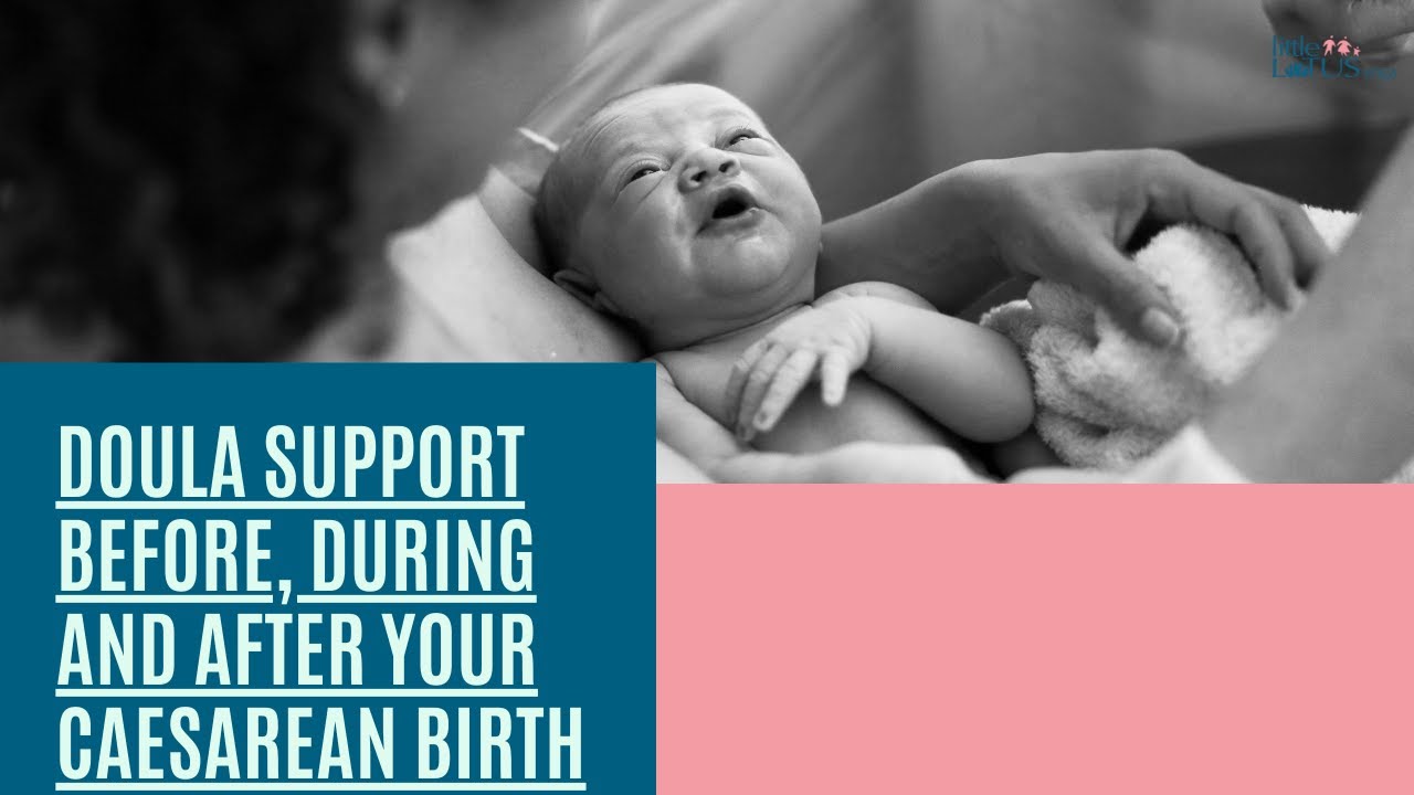 Doula Support Before, During and After Your Caesarean Birth
